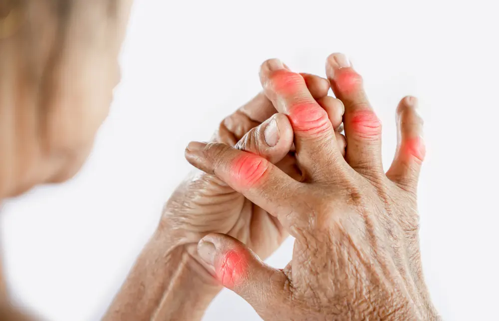 Physiotherapy Arthritis Treatment in Central London by Ludgate Clinic